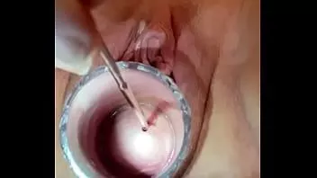 Reproducir Espasmos musculares, cuello uterino, electrosonido, dolor de llanto.